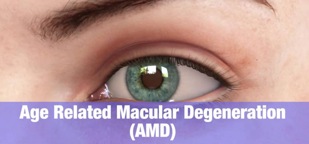 Macular Degeneration Overview