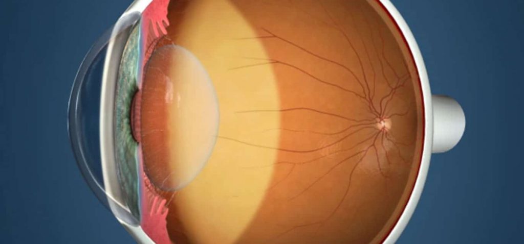 Retina Anatomy Diagram